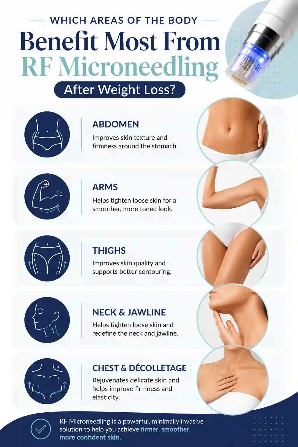 Which Areas of the Body Benefit Most From RF Microneedling After Weight Loss Glasgow